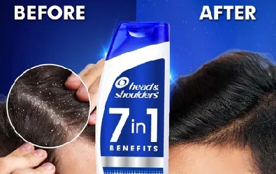 Head & Shoulders