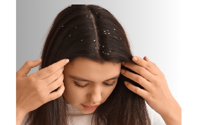 Best Shampoo For Dandruff In India By A Dermatologist