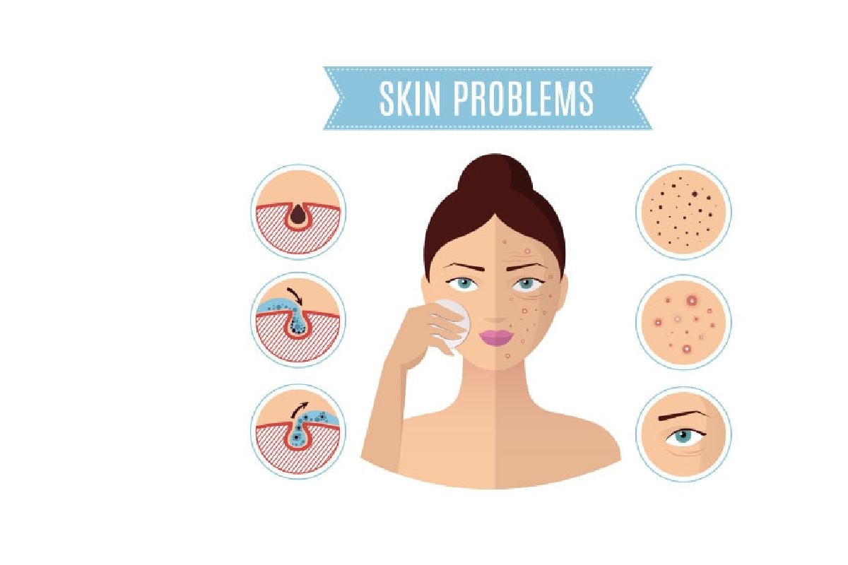 Skin Care Problems